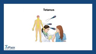 Tetanus [upl. by Wagoner]