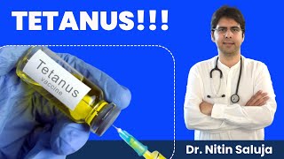 💉 Tetanus Injection time limit after injury I 💉 Tetanus  Symptoms amp Treatment [upl. by Glendon]