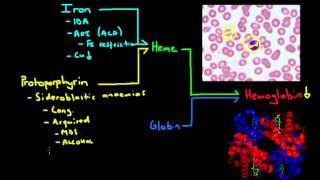 Microcytic Anemia  The Major Causes [upl. by Karol]