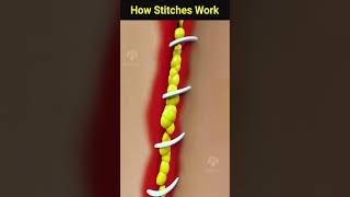 How wound stitches really work shorts facts  Creativelearning3d [upl. by Packston]