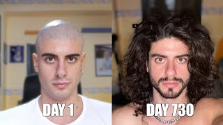 Two years time lapse of hair growth [upl. by Enitsrik354]