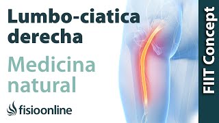 Ciáticalumbociática derecha  Visión desde la fisioterapia y la medicina natural [upl. by Julio642]