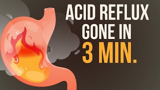 Reduce your Acid Reflux  Heartburn in just 3 Minutes 🔥 [upl. by Allebara]