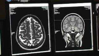 Open Your Eyes to the benefits of the Open MRI [upl. by Riek]