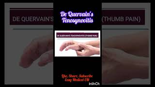 What is De Quervains TenosynovitisPhysiotherapy for Thumb Pain thumbpainshortvideo shortfeed [upl. by Haskins]