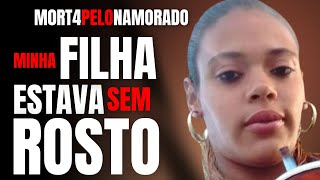 MINHA FILHA FICOU SEM ROSTO  M0RT4 PELO NAMORADO  CRIME SA [upl. by Sema50]