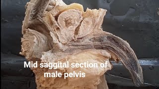 Mid saggital section of male pelvis  Dissection of pelvis  Identity structure of male pelvis [upl. by Kuska]