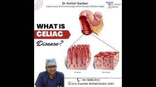 Symptoms of Celiac disease DrAshishSachan [upl. by Erodeht51]