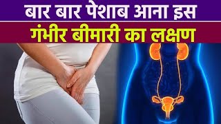 I Tried 10 Home Remedies for Frequent Urination and You Wont Believe What Happened [upl. by Cohby]