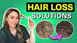 Hair Loss Treatments That Actually Work for Women amp Men  Dr Shereene Idriss [upl. by Linneman]