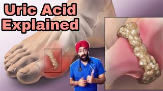 Uric Acid Problem Explained  Natural Cure amp Diet  DrEducation Hindi [upl. by Mott]