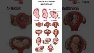 Different Baby positions During pregnancy in womb ♥️shortvideopregnancy cutebaby share fetus [upl. by Nomrah]