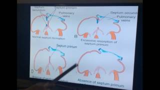 Embryology of Cardiovascular System  Part II by Dr Vijaya  Cardiac Septa amp Ventricles [upl. by Leyes]