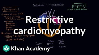 Restrictive cardiomyopathy Pathophysiology and diagnosis  NCLEXRN  Khan Academy [upl. by Yekcim567]