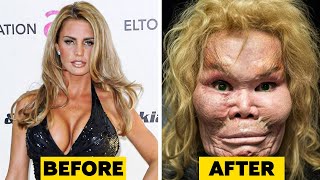 20 Celebrity Plastic Surgery Disasters [upl. by Deeann166]