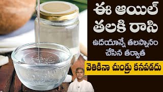 How to Reduce Dandruff Easily  Home Remedy to Scalp Reduce Itching  DrManthenas Health Tips [upl. by Esilana]