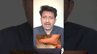 Flat Feet in kids  What parents need to know  Dr Jeya Venkatesh [upl. by Staley993]