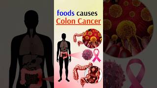 CANCER Causing Foods You Eat Every Day [upl. by Macnamara]