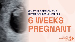 6 Weeks Pregnant Witnessing the First Heartbeat on ultrasound scan [upl. by Eissed]