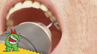 Ouvrier Devient Dentiste de Dernière Minute [upl. by Lattonia636]