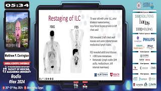 Radio Alex 2024 PET in Breast Malignancy Dr Matthew F Covington [upl. by Icyaj223]