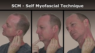 SCM Self Myofascial Release Technique [upl. by Couture974]