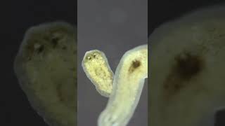 Planarian parasite flatworms under microscope [upl. by Caine]