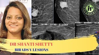 TMT BIRADS V Lesions by Dr Shanti Shetty [upl. by Iphagenia]