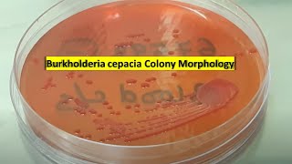 Burkholderia cepacia growth on Macconkey agar [upl. by Anailuig]