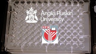 TB Detection Universiti Putra Malaysia Anglia Ruskin University UK under Newton Ungku Omar Fund [upl. by Annodam921]