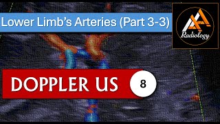 8  Lower Limbs Arteries Part 33 [upl. by Karilla]