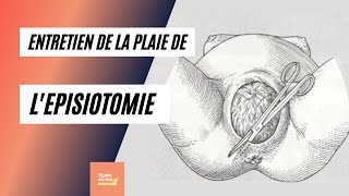 Comment entretenir la plaie de lépisiotomie [upl. by Mackenie368]