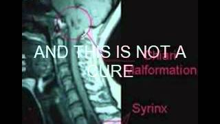 Chiari awareness video [upl. by Enella]