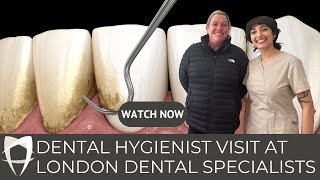 Ultimate Dental Hygienist Experience In London Dental Specialists [upl. by Aidul]