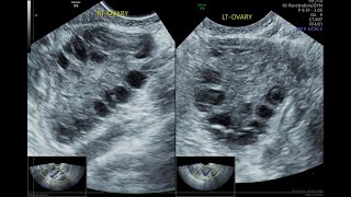 Ultrasound Spotters  Quiz  3 [upl. by Yoshi905]