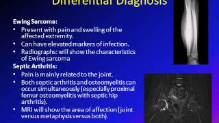 Osteomyelitis in children Bone infection in children [upl. by Delija]