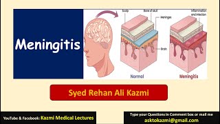 Meningitis  Neurology  Pediatric Review  KML [upl. by Nnaeiluj57]