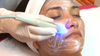 Radiofrecuencia Facial o Lifting sin cirugía [upl. by Akilegna]