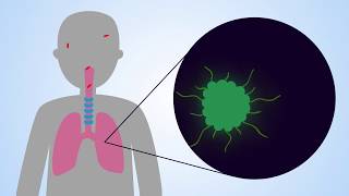 Immunotherapy using designer immune cells targeting infectious diseases [upl. by Tobin]