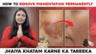 How to remove Pigmentation Permanently  Best Home Remedies  Skin Care Tips  Upasana Ki Duniya [upl. by Ahkihs317]