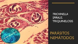 Trichinella Spiralis Triquinelosis Parásitos nemátodos [upl. by Laughry]