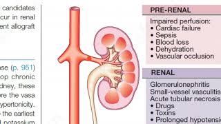 Medicine 0433 Acute Kidney Injury Renal Failure Chronic [upl. by Nedrob]