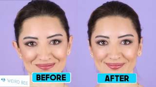 How to fix protruding ears without surgery [upl. by Sharp]