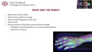 Lecture Fluorescein Angiography [upl. by Kataway]