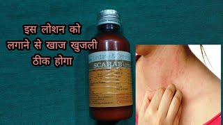 Scarab lotion  lindane and certified lotion  खाज खुलजी के दवा [upl. by Olpe]