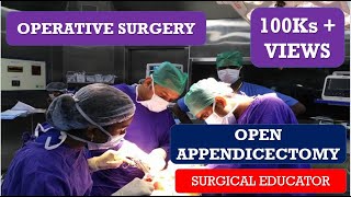 OPEN APPENDECTOMY STEP BY STEP OPERATIVE SURGERY [upl. by Aznofla]