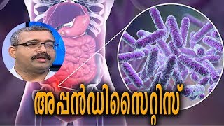 Dr Q അപ്പന്‍ഡിസൈറ്റിസ് അറിയേണ്ടതെല്ലാം  Appendicitis  26th March 2019 [upl. by Okiman443]