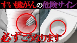 【医師監修】放置厳禁！知らないと後悔する「すい臓がんの初期症状」 [upl. by Vanderhoek]