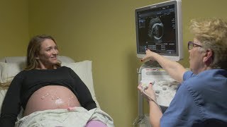 Ultrasounds during pregnancy [upl. by Olivie]