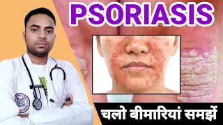 psoriasis kya hai how to treat psoriasis ❤️💥💯 raheesansari [upl. by Eggett]